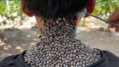 Photo of Эти КЛЕЩИ Чуть Не Сьели Парня Живьем! Удаление Сотен Клещей…